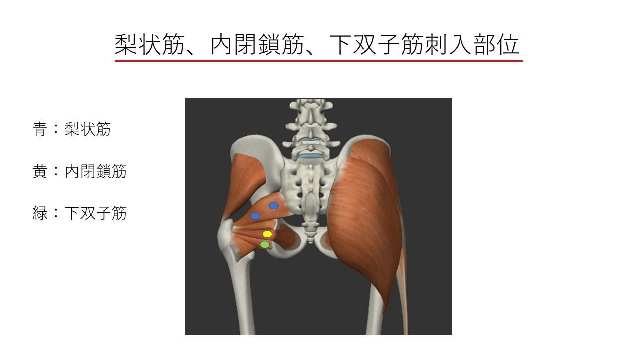 お尻の痛み ひびき堂鍼灸院