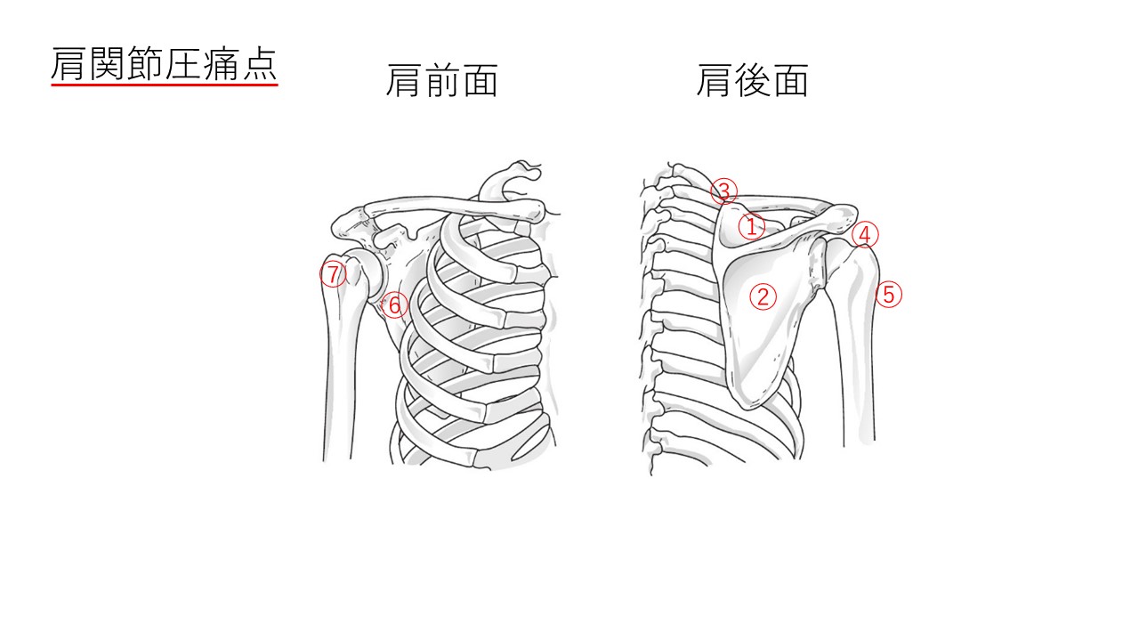 肩圧痛点のイラスト