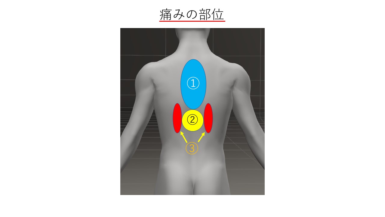 背中の痛み疼痛部位